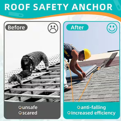 5-Pieces Permanent Roof Safety Anchor